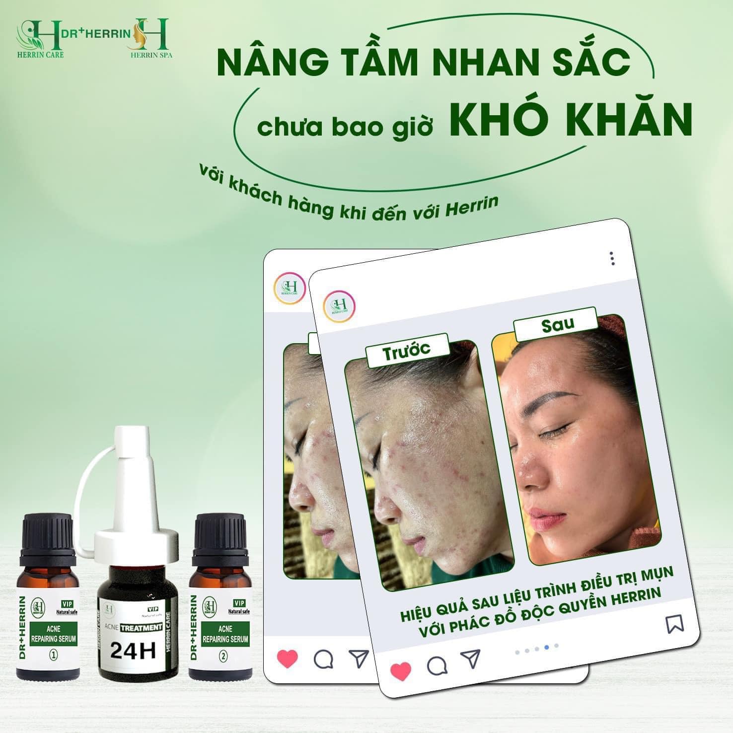 Mẫu content trị mụn - 24H