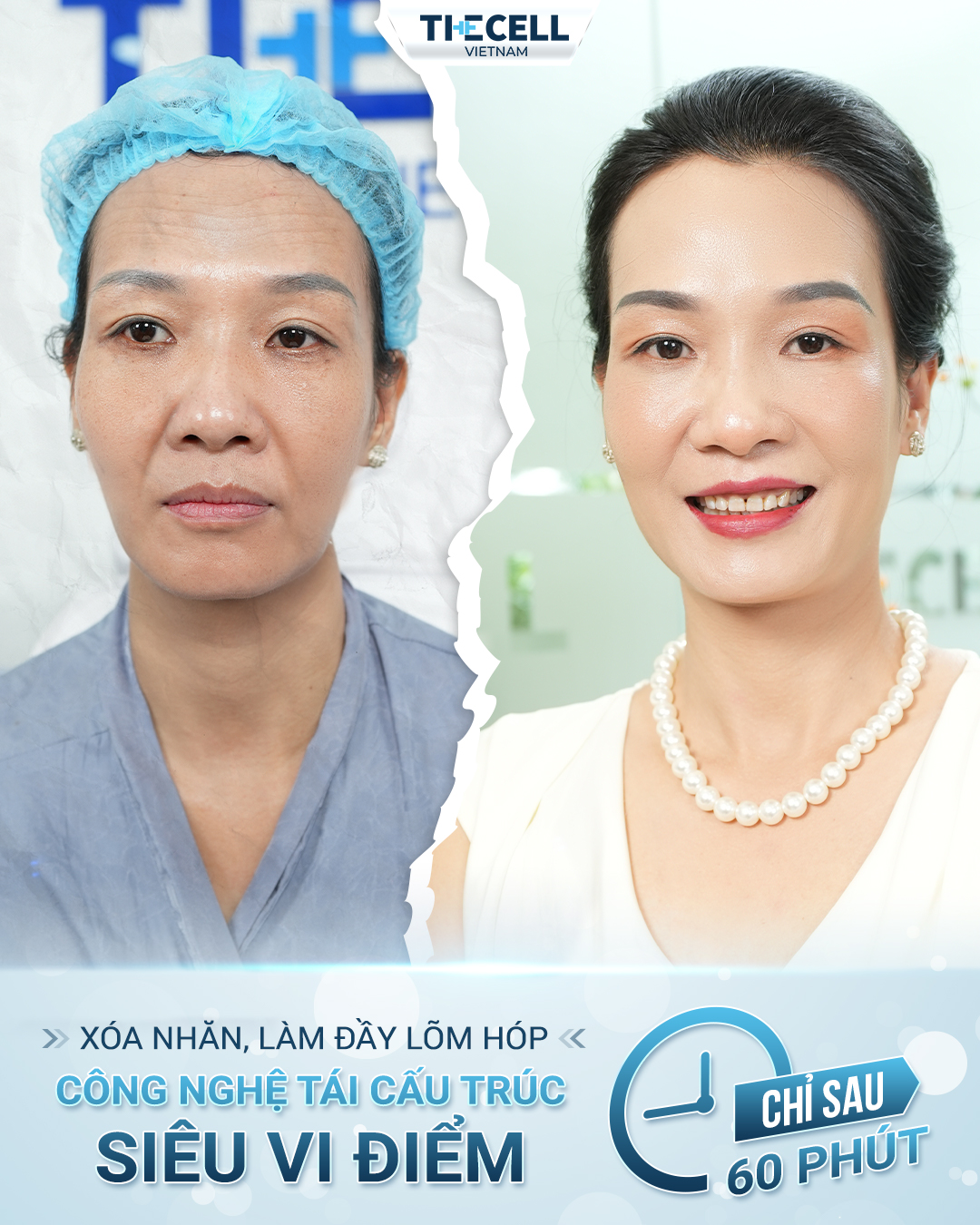 Mẫu content trị nám - The Cell